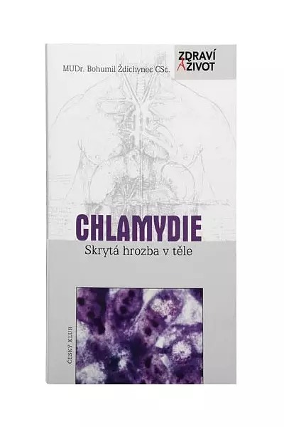 CHLAMYDIE - skrytá hrozba v těle photo