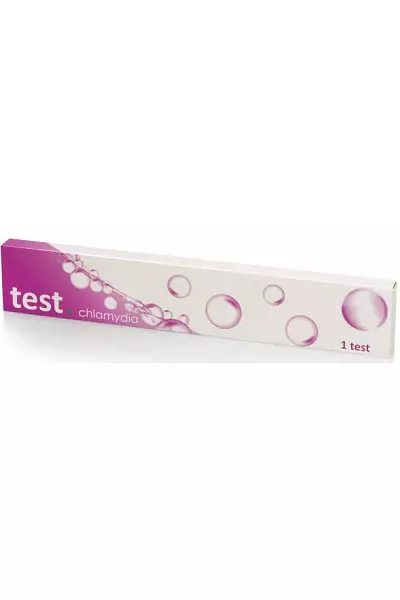 Chlamydia test photo