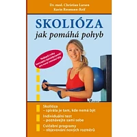 Skolióza photo