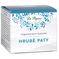 Hrubé paty foto